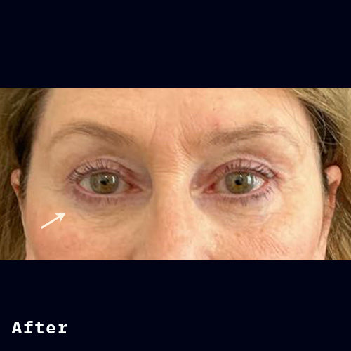 Before and after of Dr Elizabeth Hawes' previous patient