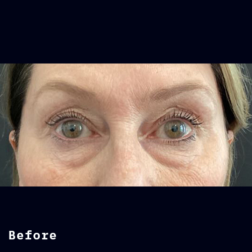 Before and after of Dr Elizabeth Hawes' previous patient