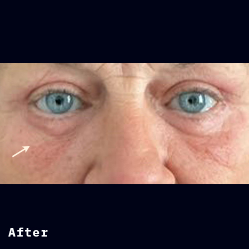 Before and after of Dr Elizabeth Hawes' previous patient