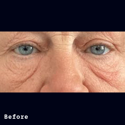 Before and after of Dr Elizabeth Hawes' previous patient