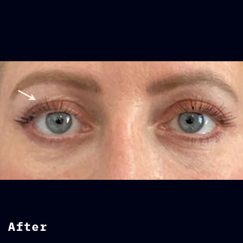Before and after of Dr Elizabeth Hawes' previous patient