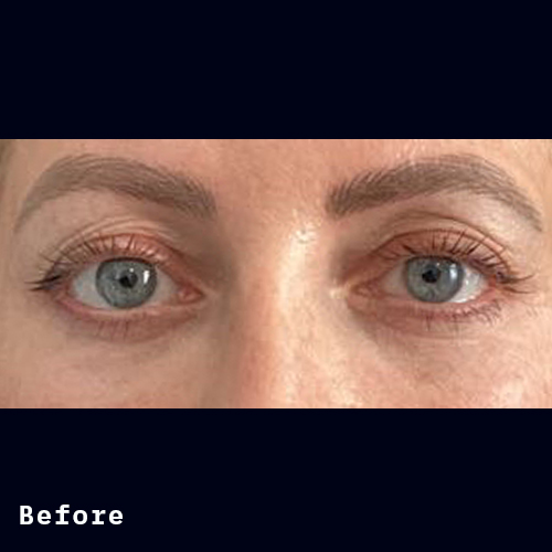 Before and after of Dr Elizabeth Hawes' previous patient