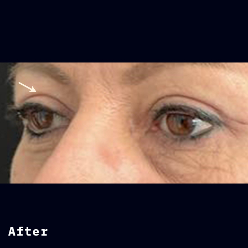 Before and after of Dr Elizabeth Hawes' previous patient