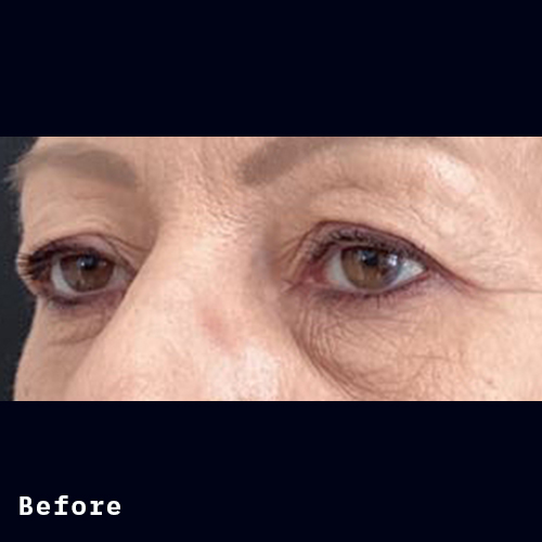 Before and after of Dr Elizabeth Hawes' previous patient