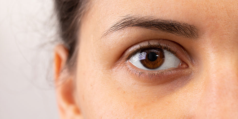 Close up profile of woman with slight dark circles in the tear trough area