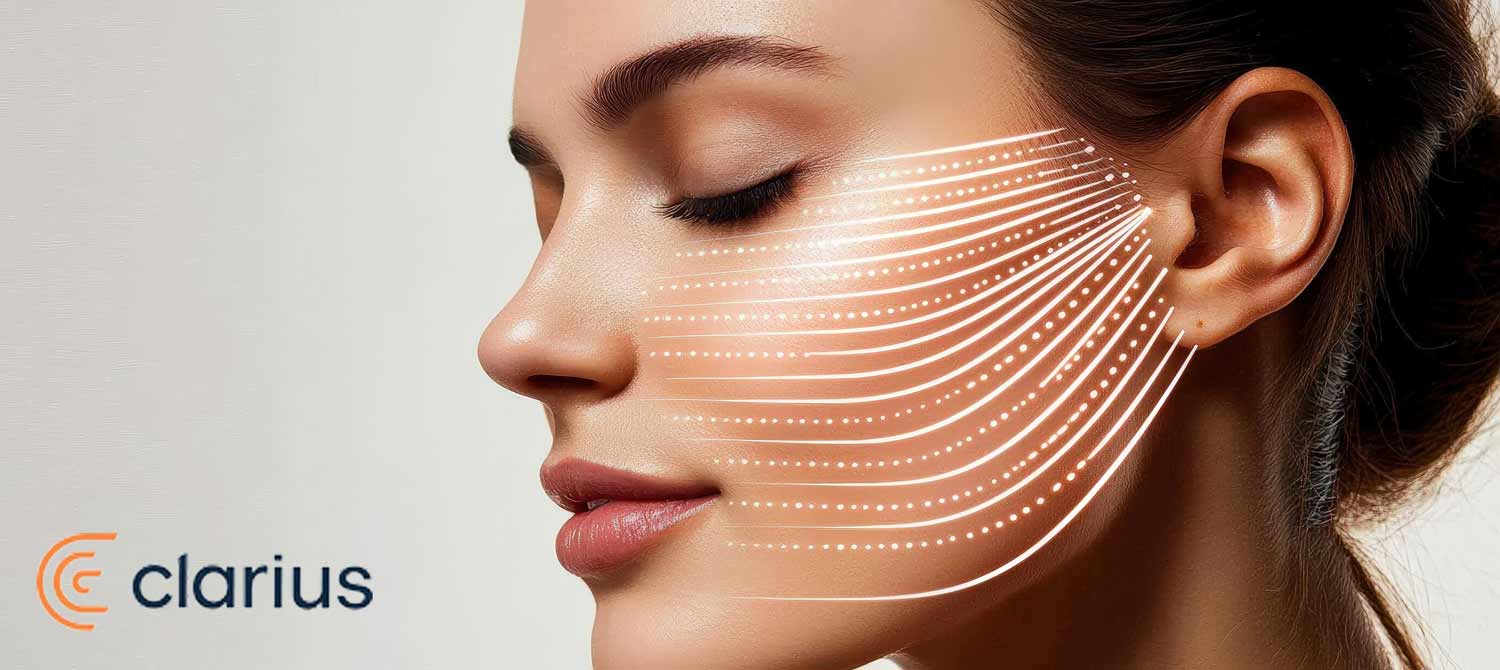 Facial ultrasound mapping for aesthetic treatments using Clarius technology Side profile of a woman’s face with facial contour lines illustrating aesthetic ultrasound treatment by Clarius