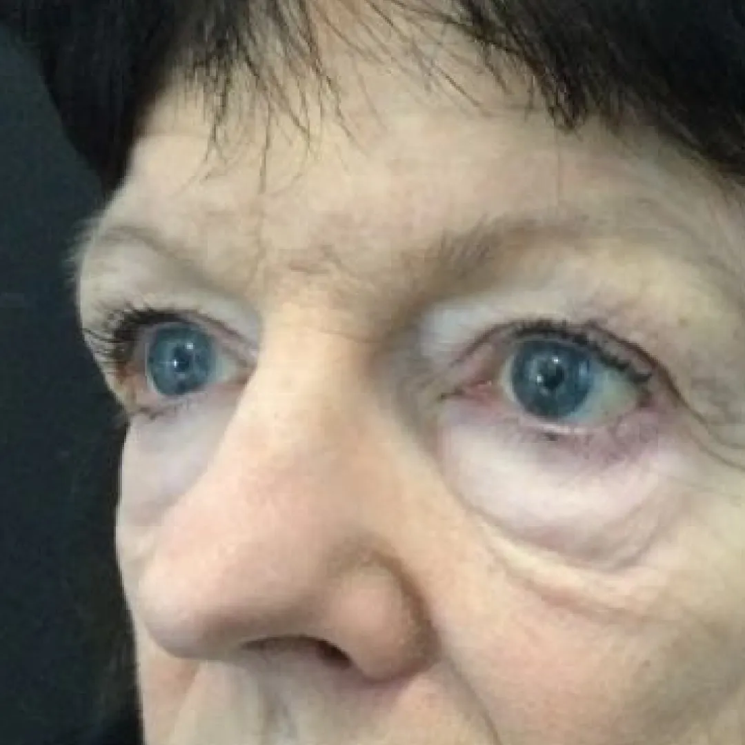Before — patient result by Dr Elizabeth Hawkes
