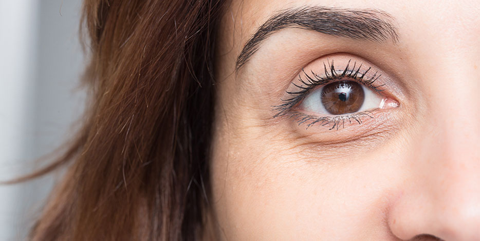 Bags Under Your Eyes? Causes & Treatments to Reduce Under-Eye Bags