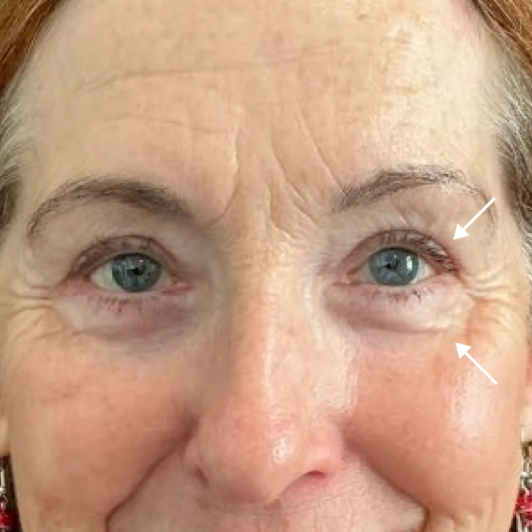 After — patient result by Dr Elizabeth Hawkes