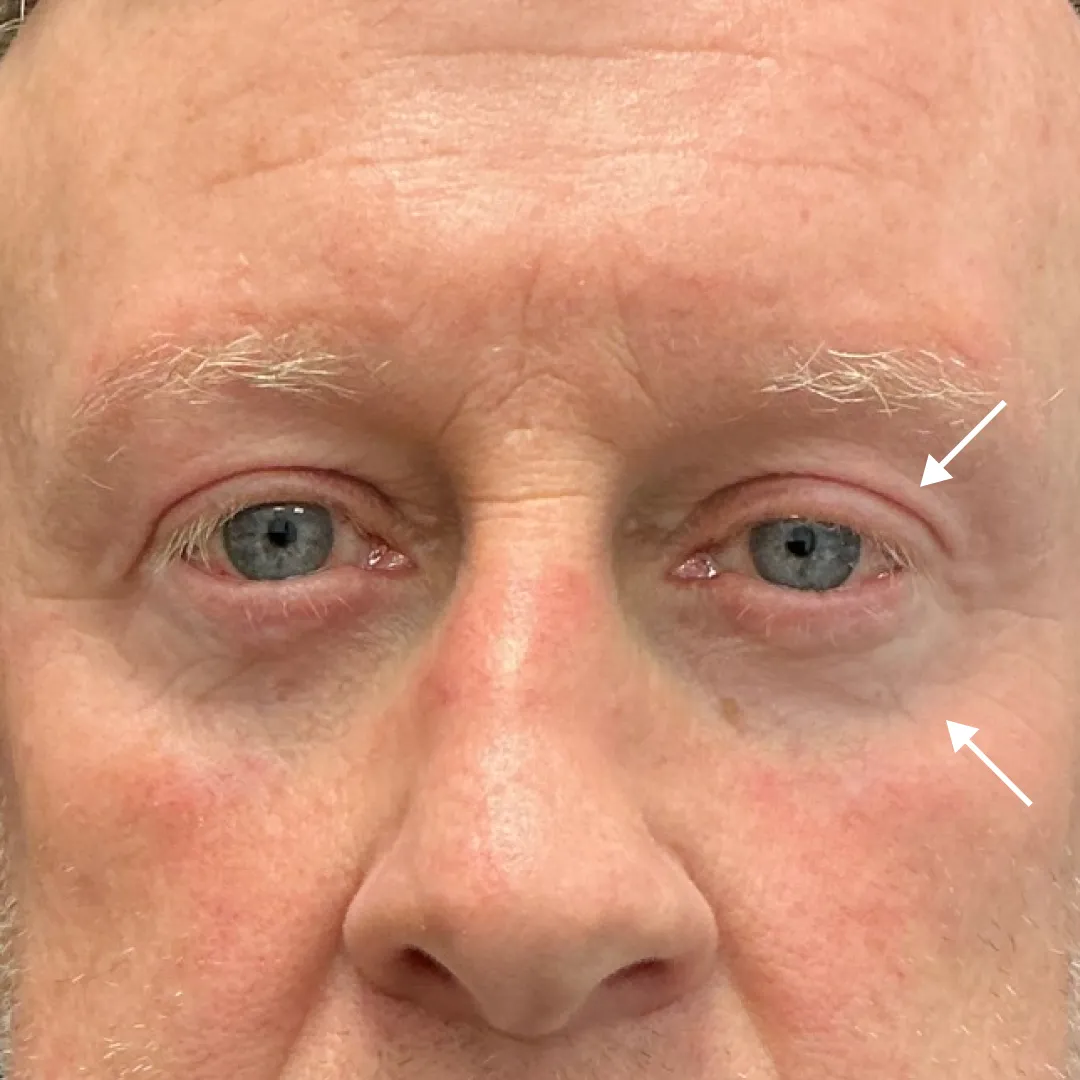 After — patient result by Dr Elizabeth Hawkes